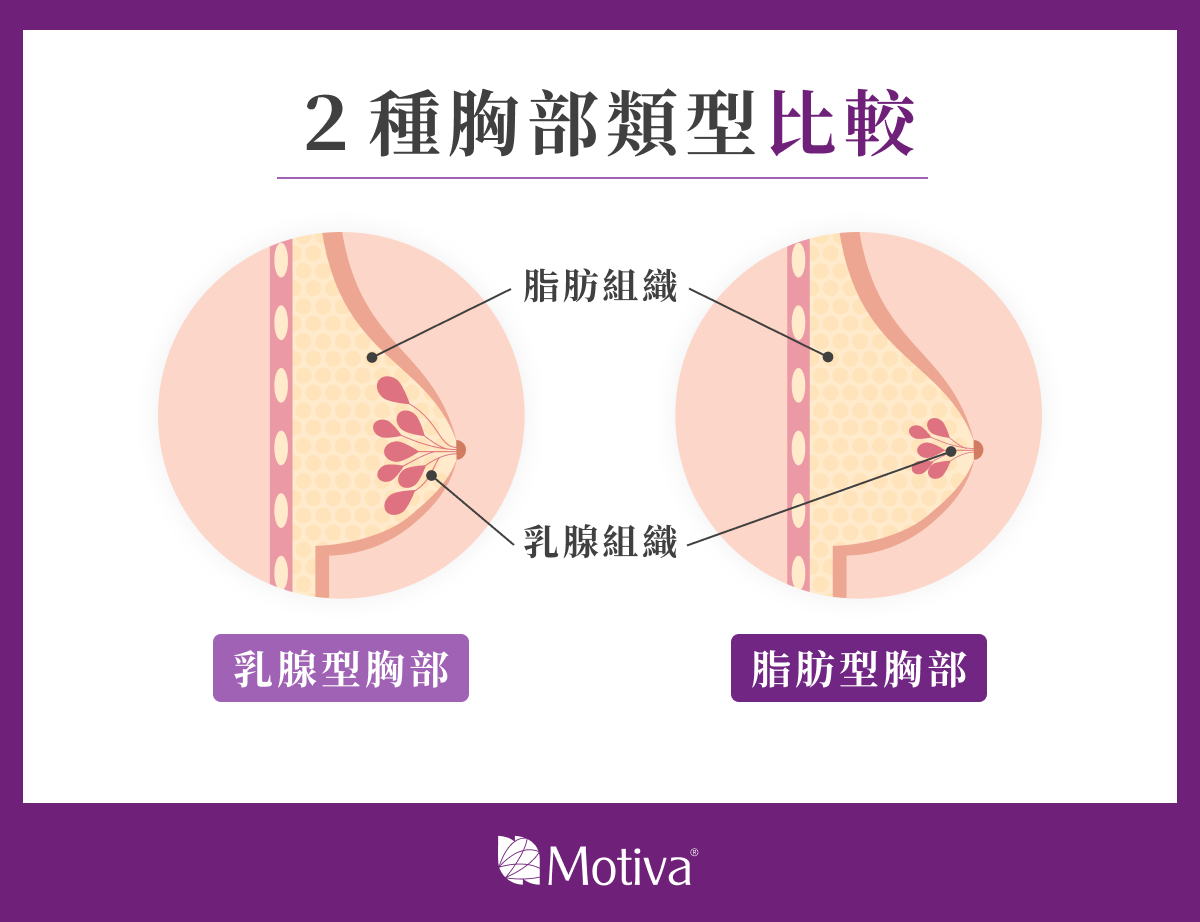 2 種胸部類型比較